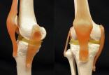 مفصل زانو,اخبار پزشکی,خبرهای پزشکی,مشاوره پزشکی