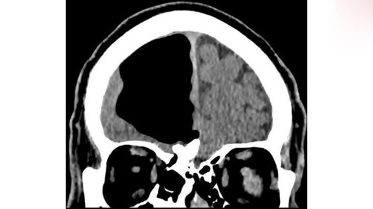 اسکن مغزِ,اخبار حوادث,خبرهای حوادث,حوادث امروز