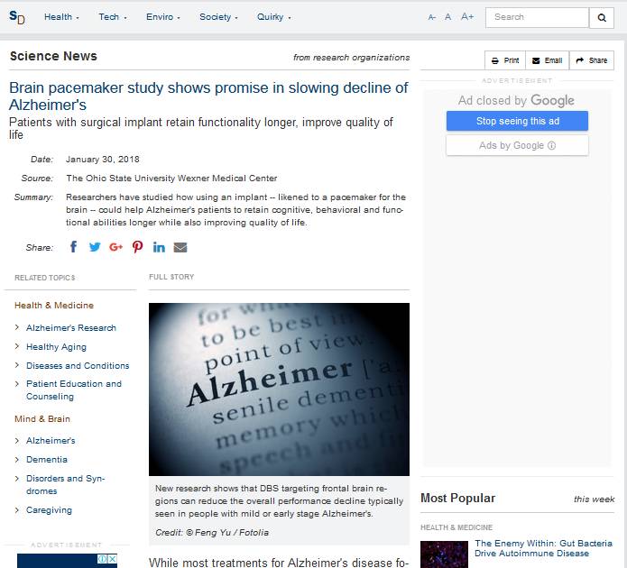 آلزایمر,اخبار پزشکی,خبرهای پزشکی,تازه های پزشکی