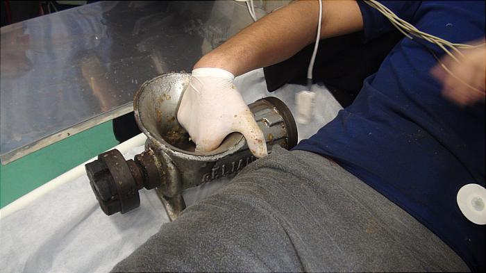 قطع انگشت با چرخ گوشت,اخبار حوادث,خبرهای حوادث,حوادث امروز