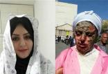 پرونده اسید پاشی تبریز,اخبار حوادث,خبرهای حوادث,جرم و جنایت