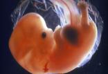 جنین,اخبار پزشکی,خبرهای پزشکی,تازه های پزشکی