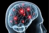 مغز,اخبار پزشکی,خبرهای پزشکی,تازه های پزشکی