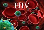 ویروس HIV,اخبار پزشکی,خبرهای پزشکی,تازه های پزشکی