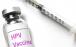 واکسن HPV,اخبار پزشکی,خبرهای پزشکی,بهداشت