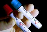 ایدز,اخبار پزشکی,خبرهای پزشکی,بهداشت