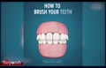 ویدئو/ طرز صحیح مسواک زدن دندان ها