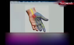 ویدئو/بررسی دست درد و راه‌های درمان آن