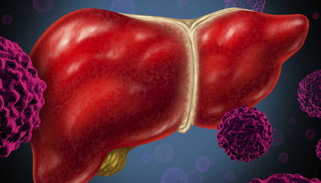 هپاتیت,اخبار پزشکی,خبرهای پزشکی,مشاوره پزشکی