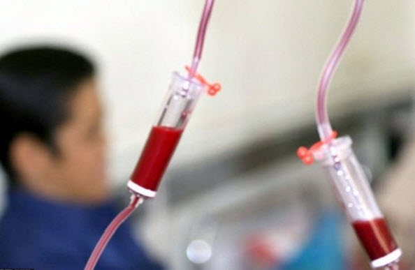 هموفیلی هموفیلی,اخبار پزشکی,خبرهای پزشکی,بهداشت