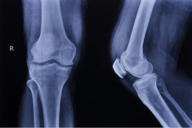 استخوان استخوان,اخبار علمی,خبرهای علمی,پژوهش