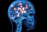 نابودی سلول های مغز,اخبار پزشکی,خبرهای پزشکی,مشاوره پزشکی