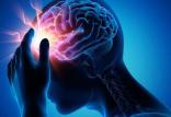 بیماری میگرن,اخبار پزشکی,خبرهای پزشکی,تازه های پزشکی