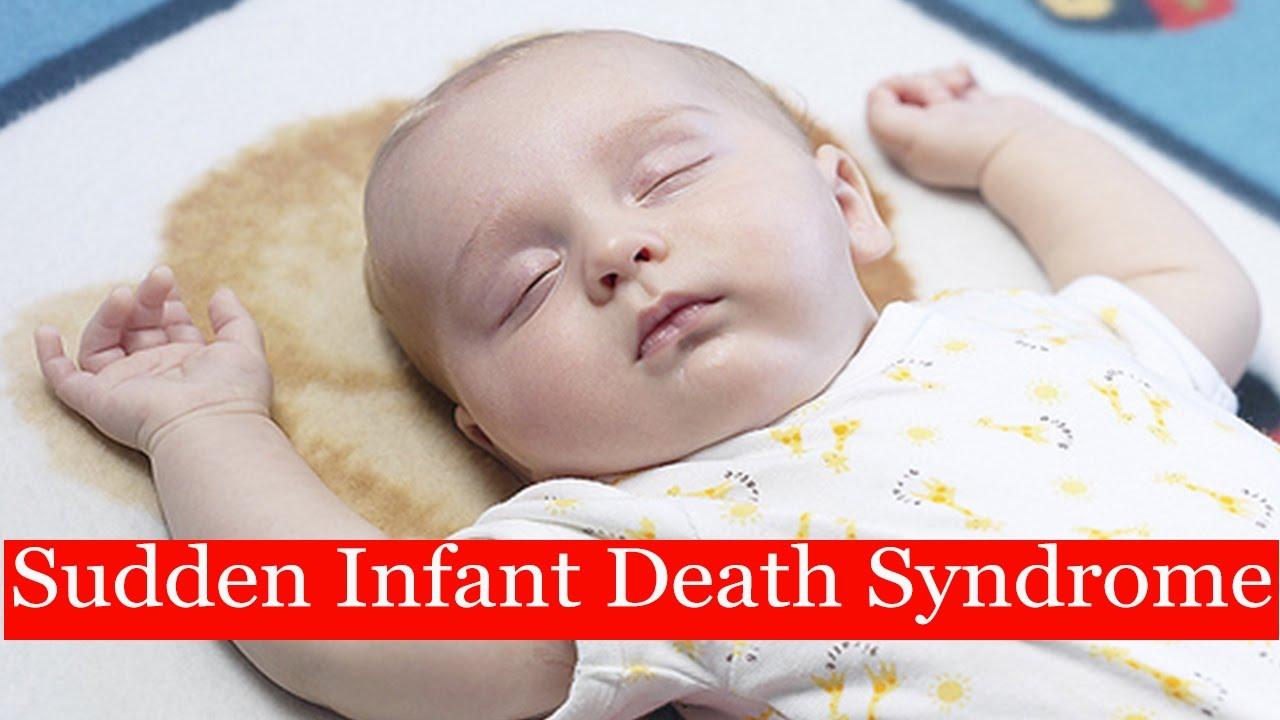 سندرم مرگ ناگهانی نوزاد,اخبار پزشکی,خبرهای پزشکی,مشاوره پزشکی
