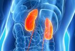 عفونت کلیه,اخبار پزشکی,خبرهای پزشکی,مشاوره پزشکی