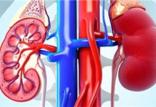 کلیه,اخبار پزشکی,خبرهای پزشکی,مشاوره پزشکی