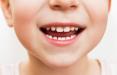 ترمیم دندان‌های کودکان با سلول‌های بنیادی,اخبار پزشکی,خبرهای پزشکی,تازه های پزشکی