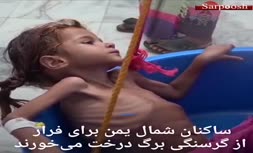 فیلم/ خطر مرگ در کمین ۱۱ میلیون کودک یمنی به سبب نبود غذا