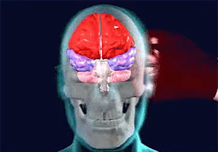 آسیب‌های مغزی,اخبار علمی,خبرهای علمی,پژوهش