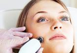 پرمویی صورت زنان,اخبار پزشکی,خبرهای پزشکی,مشاوره پزشکی