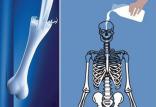 سلامت استخوان‌,اخبار پزشکی,خبرهای پزشکی,مشاوره پزشکی