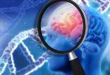 آلزایمر,اخبار پزشکی,خبرهای پزشکی,تازه های پزشکی