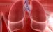 انسداد ریه (COPD)