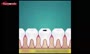 ویدئو/نحوه عصب کشی دندان