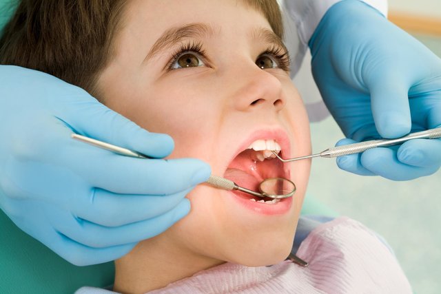 پوسیدگی دندان کودکان,اخبار پزشکی,خبرهای پزشکی,مشاوره پزشکی