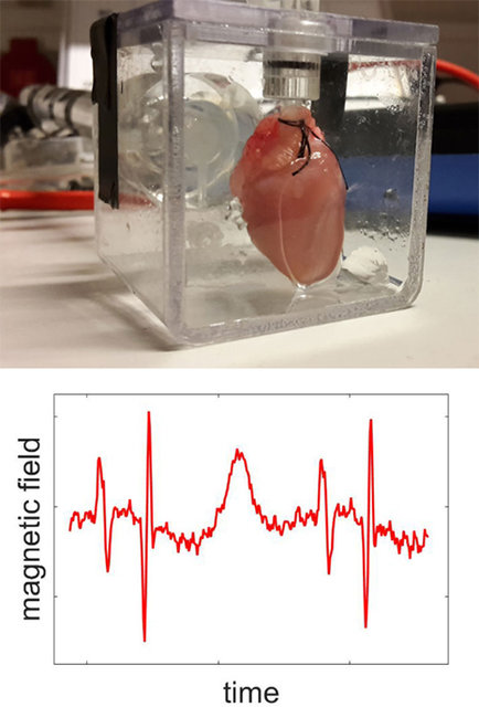 ارزیابی فعالیت الکتریکی قلب جنین,اخبار علمی,خبرهای علمی,اختراعات و پژوهش