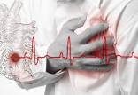 سکته قلبی,اخبار پزشکی,خبرهای پزشکی,مشاوره پزشکی
