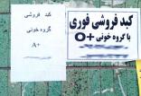 فروش یک تکه کبد 150 میلیون تومان! فروش کبد,اخبار اجتماعی,خبرهای اجتماعی,آسیب های اجتماعی