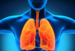 تاثیر بیماری‌های ریوی بر آلزایمر,اخبار پزشکی,خبرهای پزشکی,تازه های پزشکی