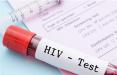 ویروس HIV,اخبار پزشکی,خبرهای پزشکی,بهداشت
