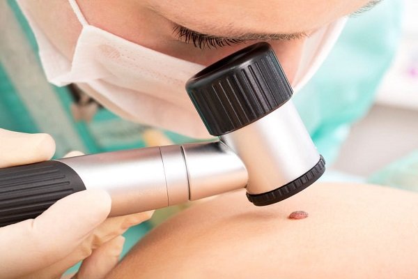 پیشگیری سرطان پوست,اخبار پزشکی,خبرهای پزشکی,تازه های پزشکی