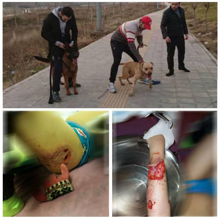 حمله دو سگ به یک کودک در لواسان,اخبار اجتماعی,خبرهای اجتماعی,حقوقی انتظامی
