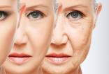 پیری,اخبار پزشکی,خبرهای پزشکی,تازه های پزشکی