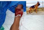 حمله سگ به دختربچه,اخبار اجتماعی,خبرهای اجتماعی,جامعه