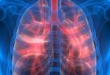 ریه,اخبار پزشکی,خبرهای پزشکی,تازه های پزشکی