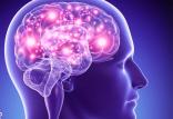 تصویربرداری از مغز,اخبار پزشکی,خبرهای پزشکی,تازه های پزشکی
