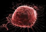 سرطان,اخبار پزشکی,خبرهای پزشکی,بهداشت