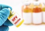 واکسن HPV,اخبار پزشکی,خبرهای پزشکی,بهداشت