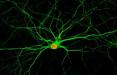 تبدیل سلول‌ها به نورون‌ برای ترمیم آسیب‌های مغزی,اخبار پزشکی,خبرهای پزشکی,تازه های پزشکی