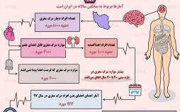 اینفوگرافیک آمار اهدای عضو در ایران