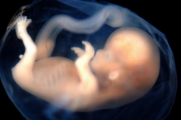 رشد جنین در رحم مصنوعی,اخبار پزشکی,خبرهای پزشکی,تازه های پزشکی