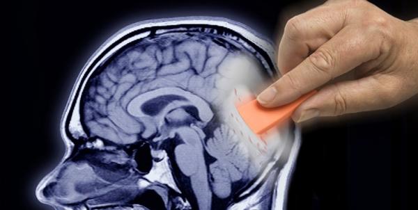 درمان آلزایمر درمان آلزایمر,اخبار پزشکی,خبرهای پزشکی,تازه های پزشکی