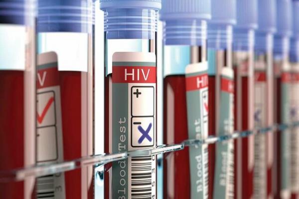 بیماری HIV,اخبار پزشکی,خبرهای پزشکی,تازه های پزشکی