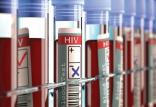 بیماری HIV,اخبار پزشکی,خبرهای پزشکی,تازه های پزشکی