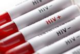 آزمایش ایدز,اخبار پزشکی,خبرهای پزشکی,تازه های پزشکی