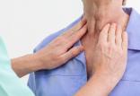 عوامل کم‌کاری و پرکاری تیروئید,اخبار پزشکی,خبرهای پزشکی,تازه های پزشکی